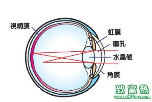 眼睛散光是什么意思？