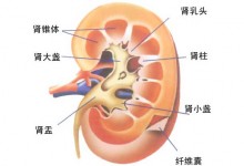 肾结石患者的饮食禁忌