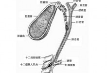 胆结石不能吃什么食物