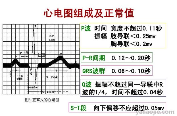 心電圖怎麼看